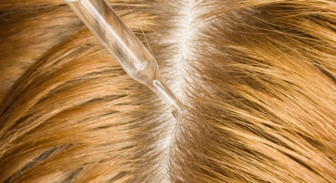 🧯Scalp Inflammation and How to Treat It to Reduce Hair Loss - SAVE ME FROM